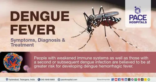 Symptoms of Dengue Fever